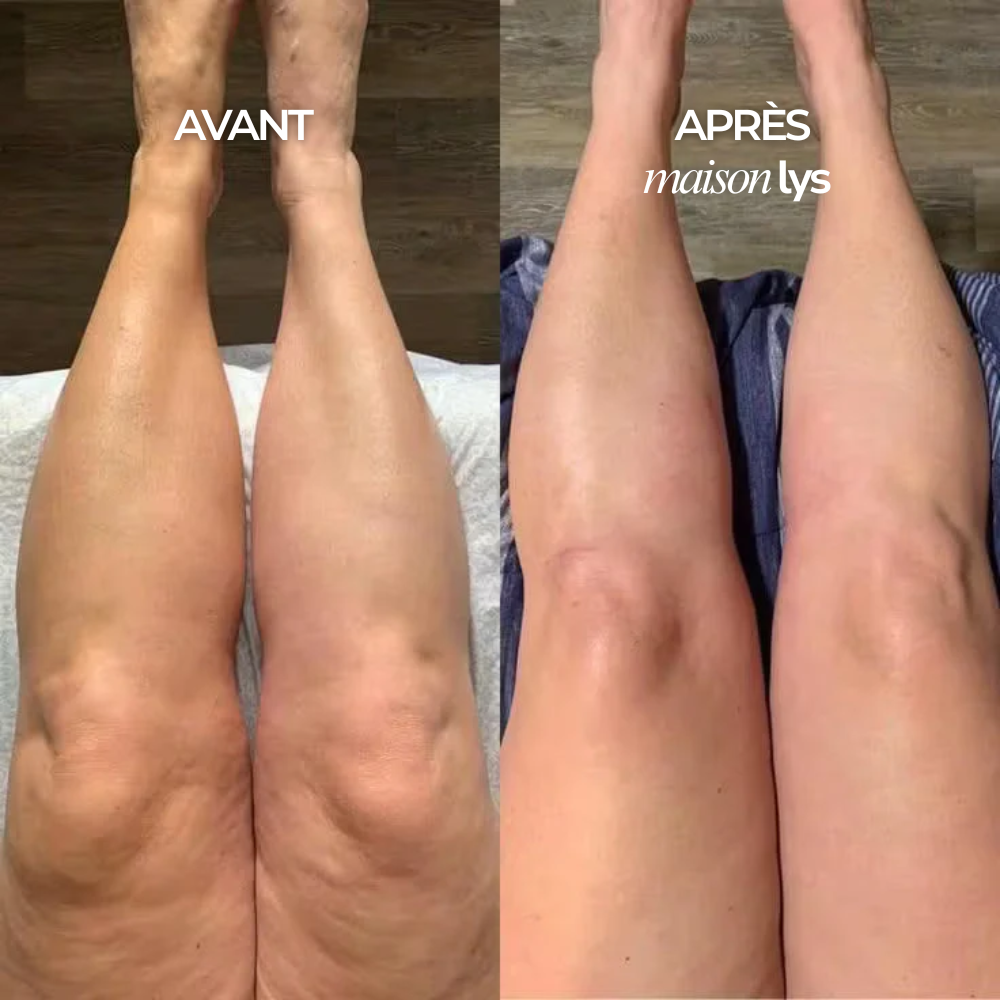 Wohlfühl-Tropfen Lymphdrainage