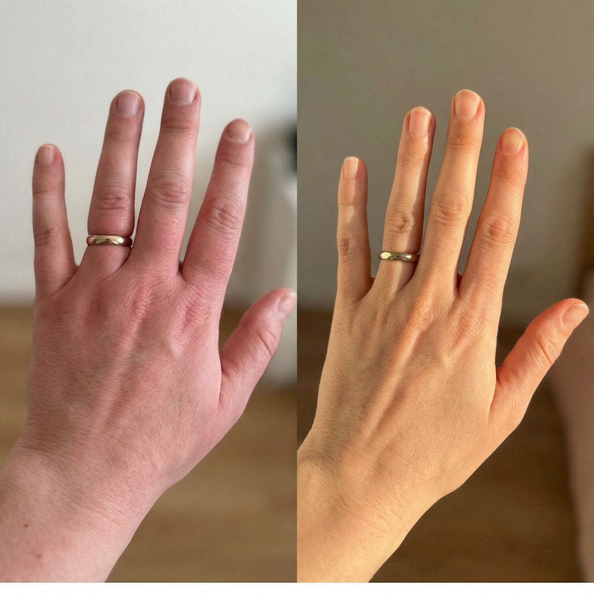 Lymphdrainage-Tropfen – Leichte Hände & Schlanke Finger - 59 ml