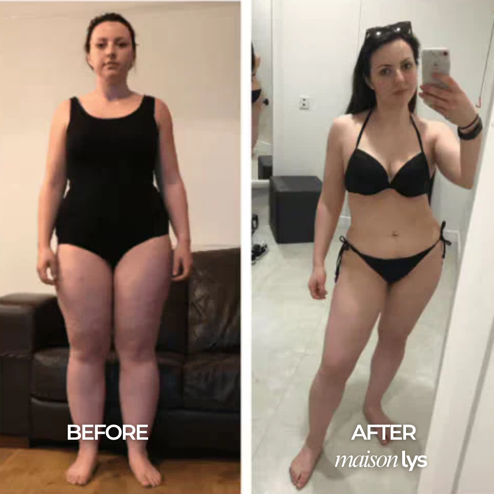 Before and after